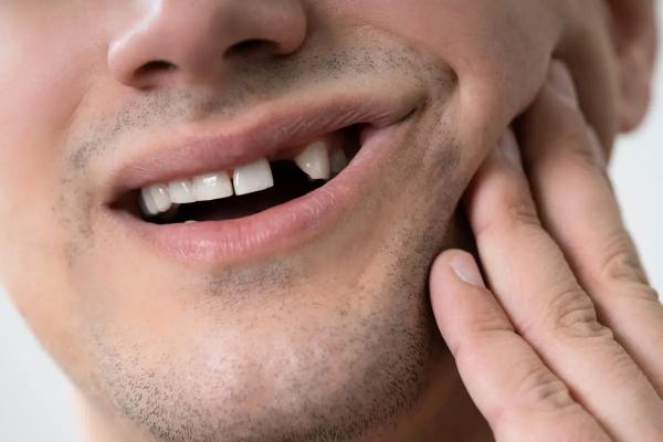 Минус зуб – почему нельзя оставить все как есть? Чем грозит отсутствие зуба?